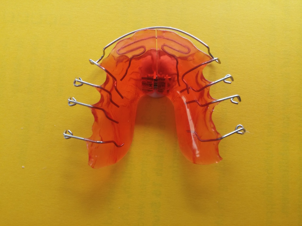 破解牙齿矫正四谣言